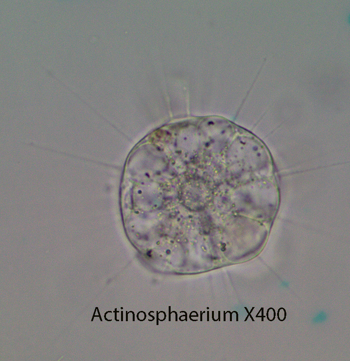 Amoeba Actinospherium spp