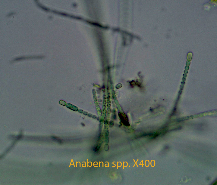 Bluegreen Bacteria Anabena spp