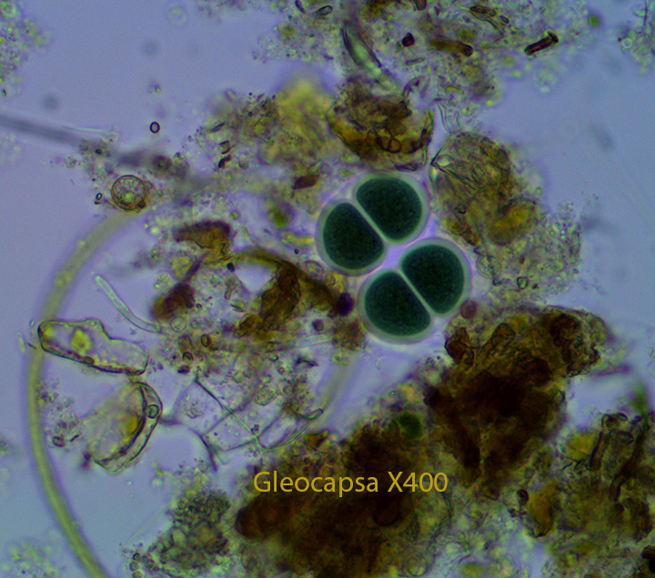 Bluegreen Bacterium Gloeocapsa spp