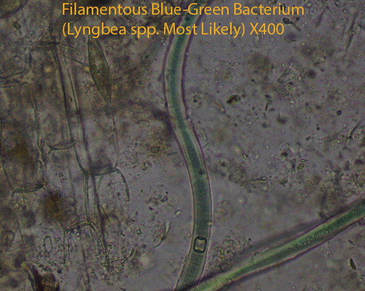 Bluegreen  Bacterium  (Unidentified) X400 HVNC between open water and end of black spruce zone 9 15 2012  (10)