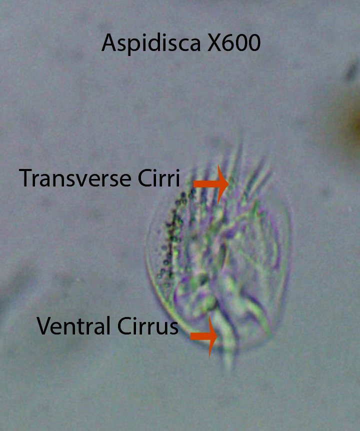 Ciliate Aspidisca Ventral X600 TP Pool May 6 2015