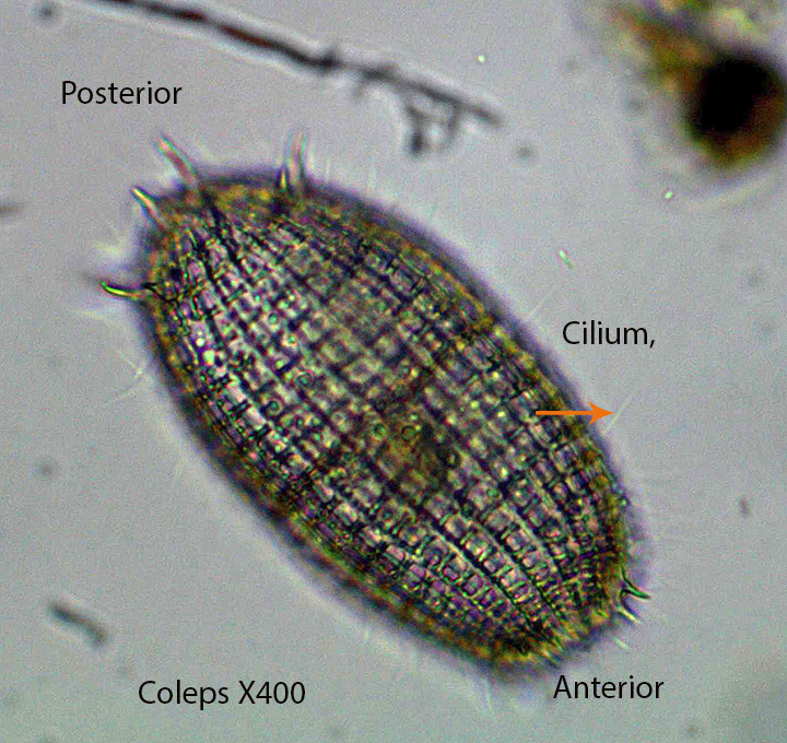 Ciliate Coleps spp