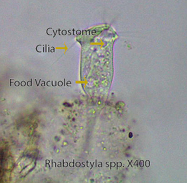 Ciliate Rhabdostyla spp