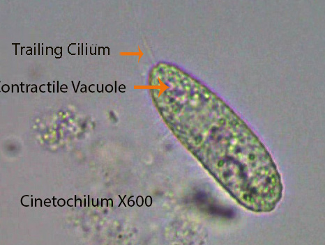Ciliate small trailing cilia Cinetochilum spp - Copy