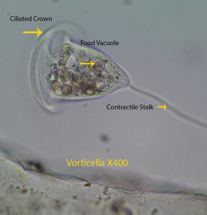 Ciliate Vorticella sppvc.jpg