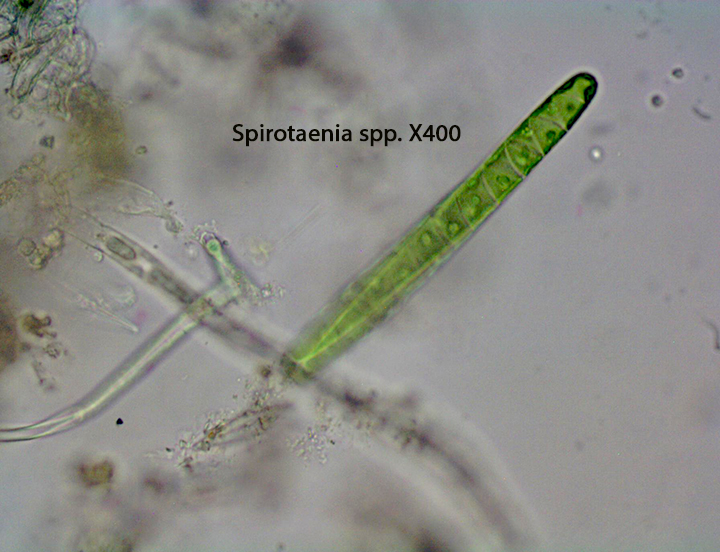 Desmid Spirotaenia  spp