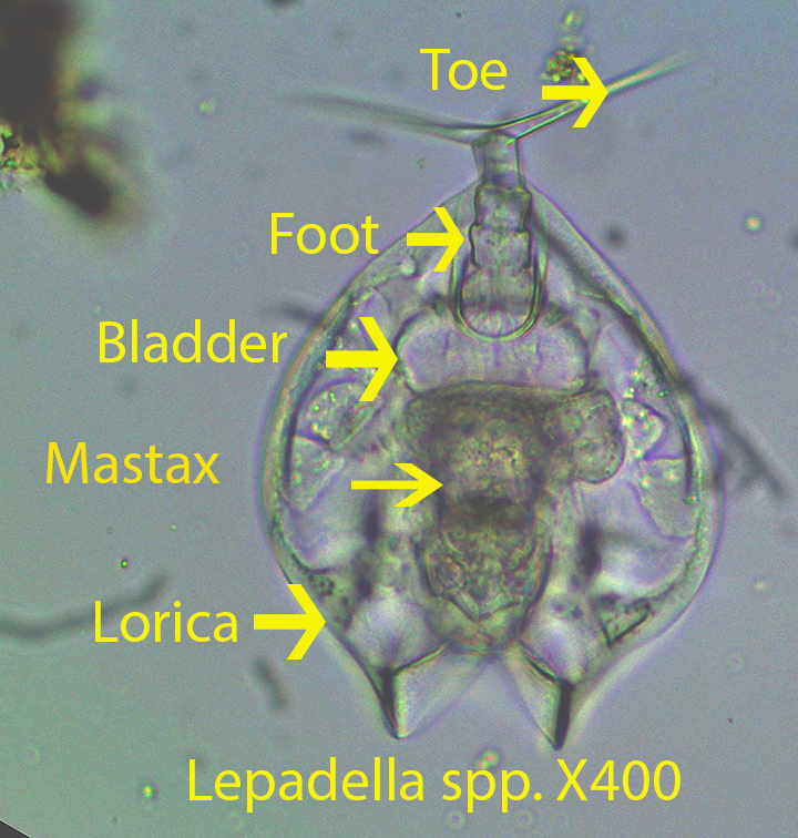 Lepadella spp Good X400 Sphagnum Site 1 HVNC Sept 4 2013 (1)
