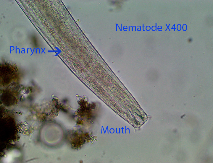 Nematode Female X400 Excellent BP Cathance 7 21 2014 (1)