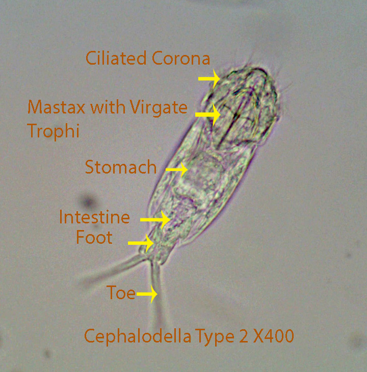 Rotifer Cephalodella spp