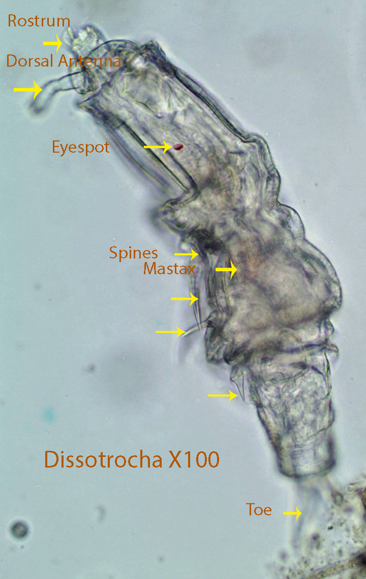 Rotifer Dissotrocha spp.jpg