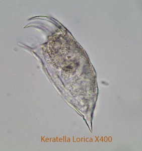Rotifer Keratella spp