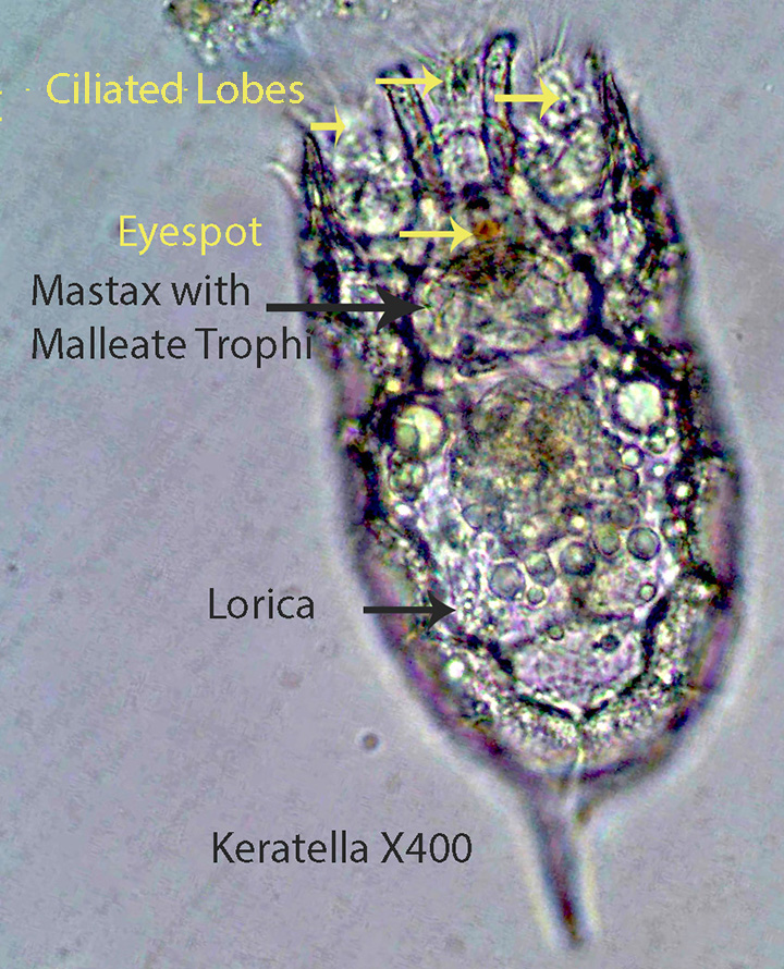 Rotifer Keratella spp.jpg