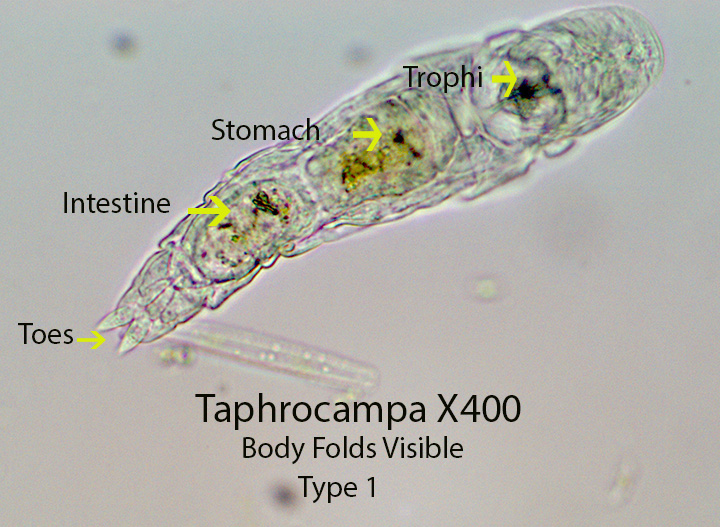 Rotifer Taphrocampa spp