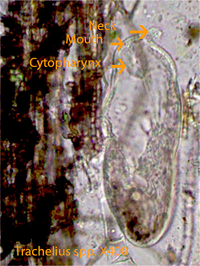 The Ciliate Trachelius spp